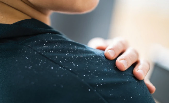 especial GC | Produtos anticaspa: oportunidade de vendas no inverno